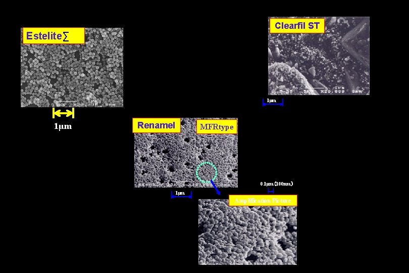 Clearfil ST Estelite∑ 1μm Renamel MFRtype 0. 1μm（100 nm） 1μm Amplification Picture 