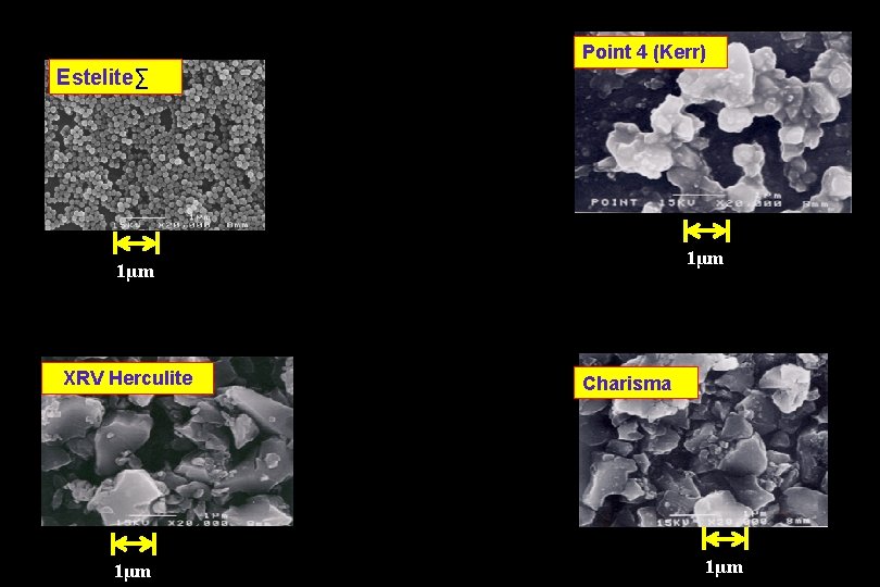 Point 4 (Kerr) Estelite∑ 1μm XRV Herculite 1μm Charisma 1μm 