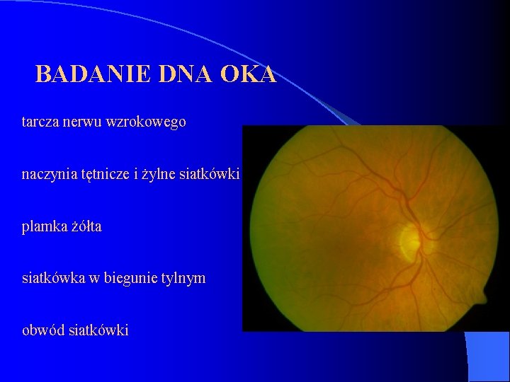  BADANIE DNA OKA tarcza nerwu wzrokowego naczynia tętnicze i żylne siatkówki plamka żółta