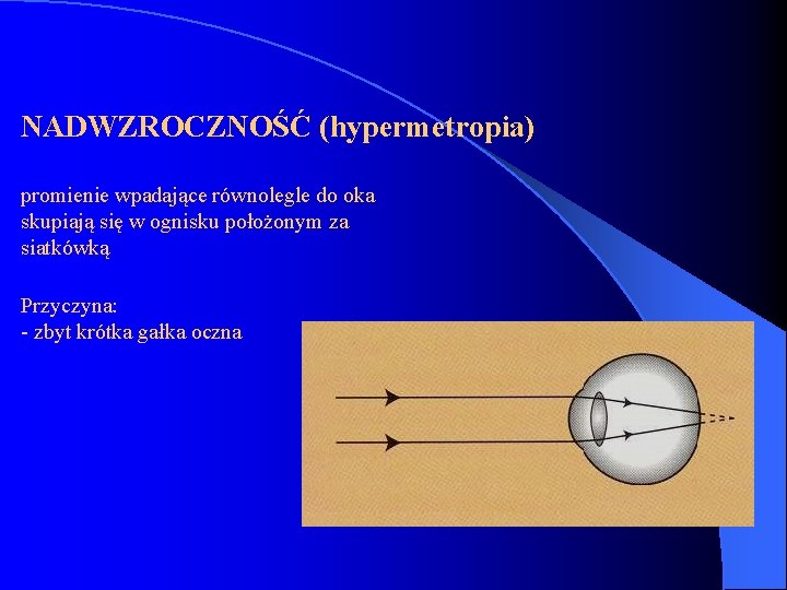 NADWZROCZNOŚĆ (hypermetropia) promienie wpadające równolegle do oka skupiają się w ognisku położonym za siatkówką