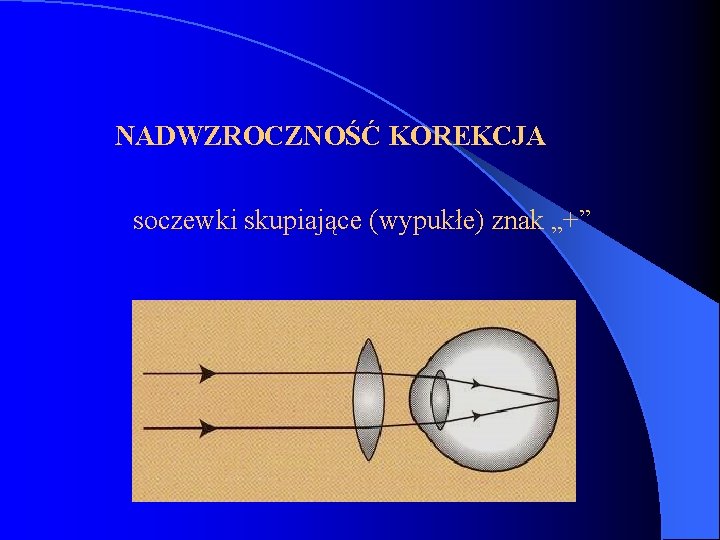 NADWZROCZNOŚĆ KOREKCJA soczewki skupiające (wypukłe) znak „+” 