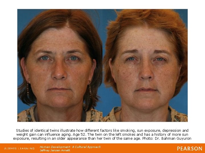 Studies of identical twins illustrate how different factors like smoking, sun exposure, depression and