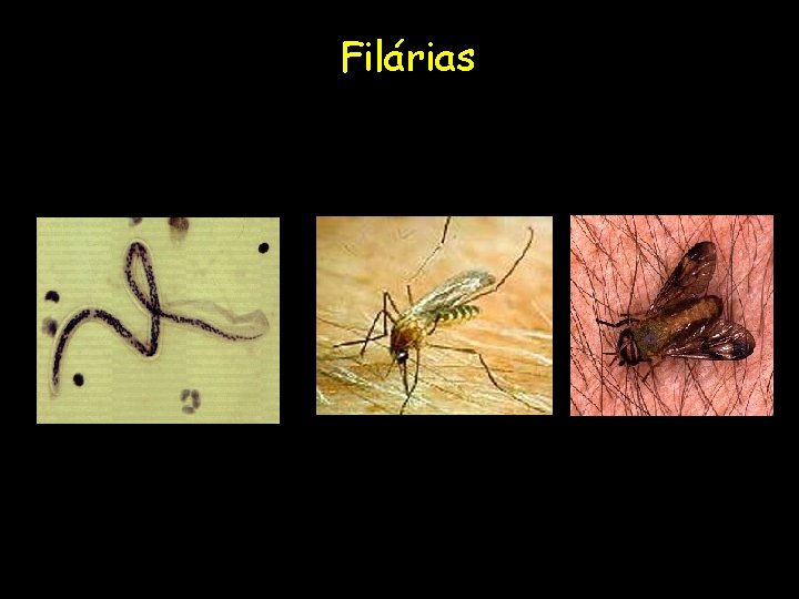 Filárias 