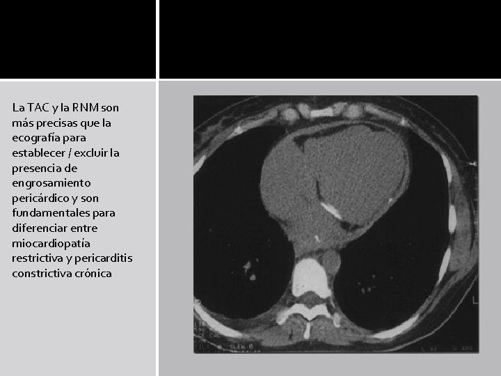 La TAC y la RNM son más precisas que la ecografía para establecer / La TAC y la RNM son más precisas que la ecografía para establecer /