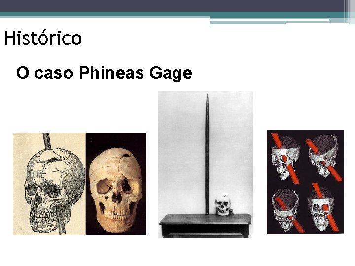 Histórico O caso Phineas Gage 