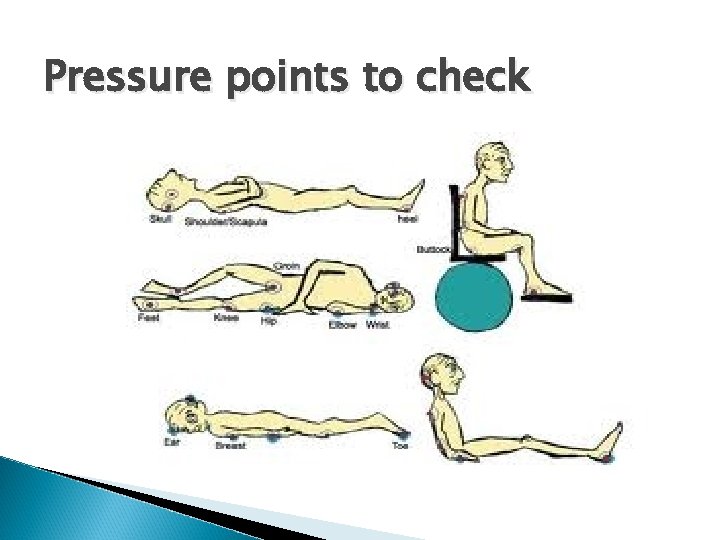 Pressure points to check 