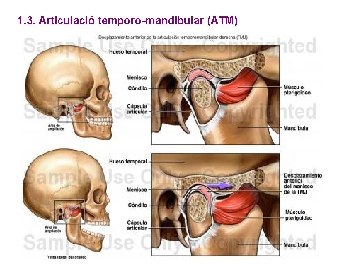 1. 3. Articulació temporo-mandibular (ATM) 