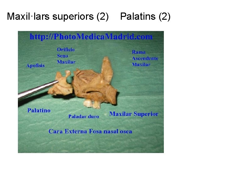 Maxil·lars superiors (2) Palatins (2) 