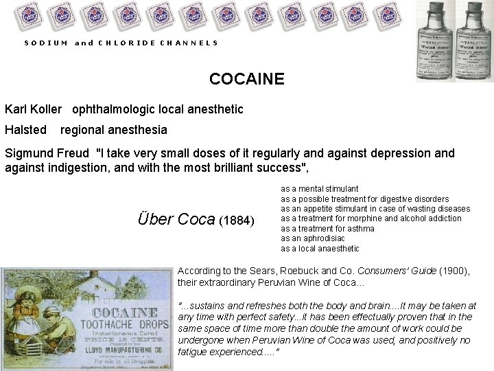 SODIUM and CHLORIDE CHANNELS COCAINE Karl Koller ophthalmologic local anesthetic Halsted regional anesthesia Sigmund