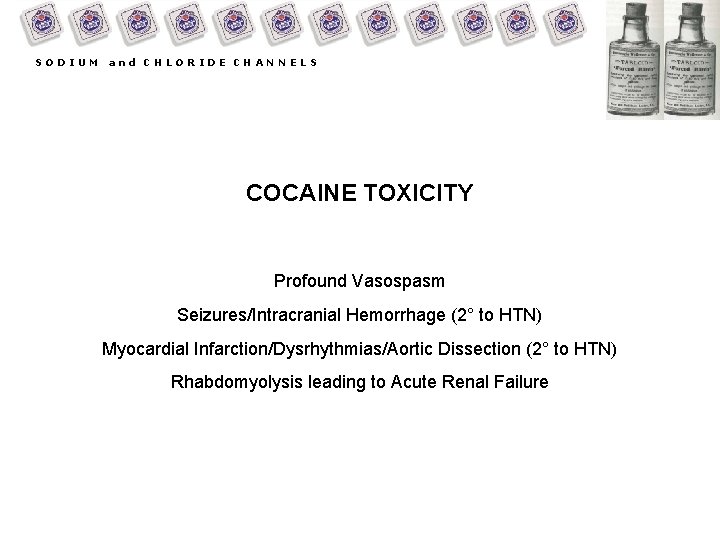 SODIUM and CHLORIDE CHANNELS COCAINE TOXICITY Profound Vasospasm Seizures/Intracranial Hemorrhage (2° to HTN) Myocardial