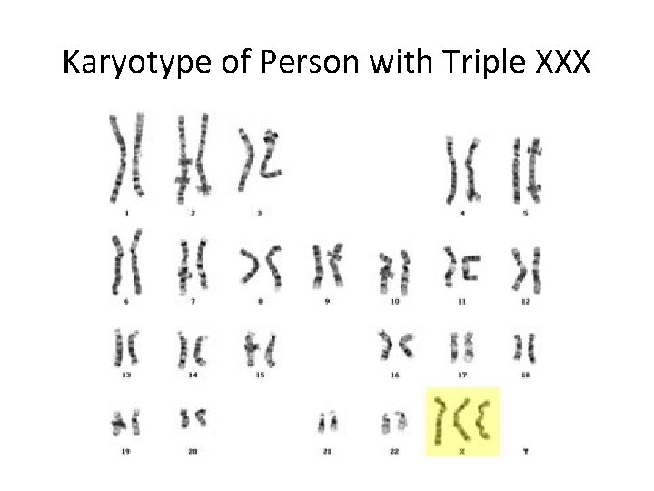 Karyotype of Person with Triple XXX 