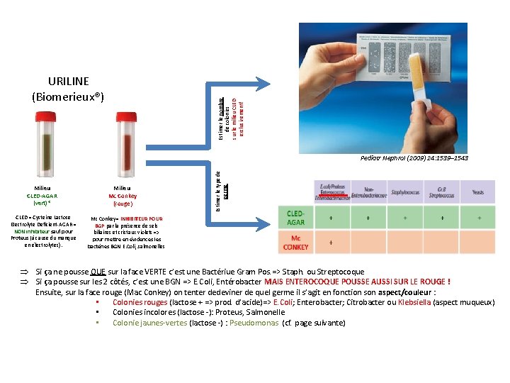 Estimer le nombre de colonies sur le milieu CLED exclusivement! URILINE (Biomerieux®) Milieu CLED-AGAR