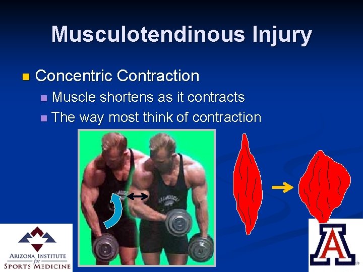 Musculotendinous Injury n Concentric Contraction Muscle shortens as it contracts n The way most