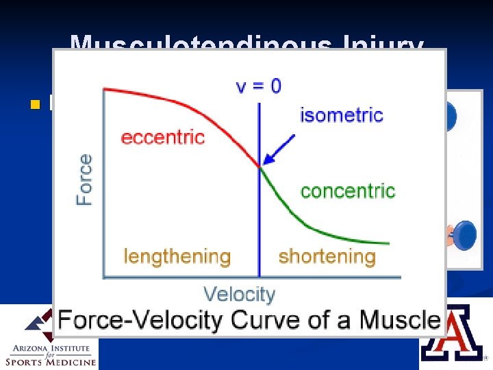 Musculotendinous Injury n Eccentric Contraction Muscle lengthens as it contracts n Typically to “slowdown”