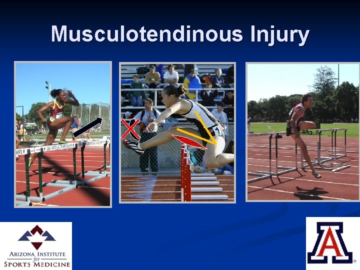 Musculotendinous Injury 