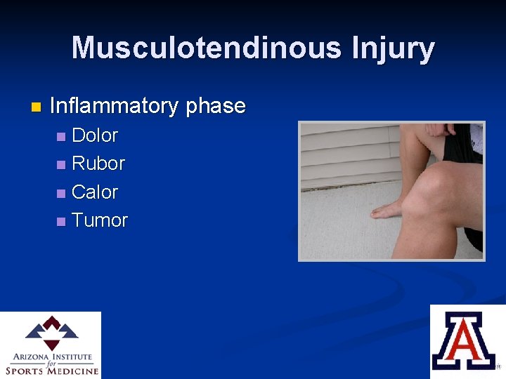 Musculotendinous Injury n Inflammatory phase Dolor n Rubor n Calor n Tumor n 
