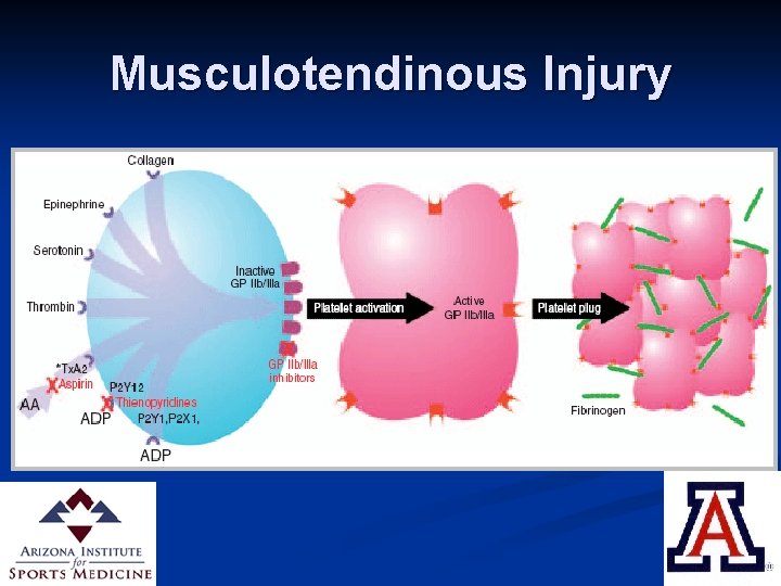 Musculotendinous Injury Inflammatory phase n Following muscle injury: n Disruption of vasculature n “Damage
