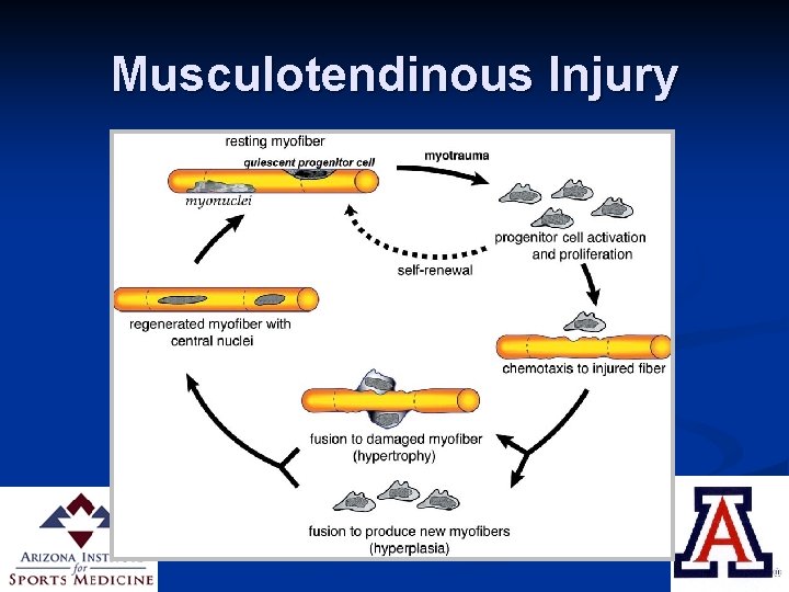 Musculotendinous Injury 
