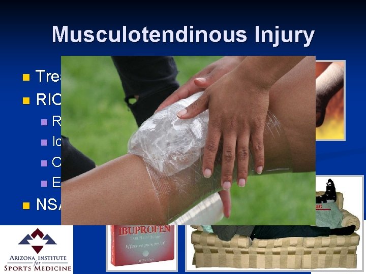Musculotendinous Injury Treatment n RICE n Rest n Ice n Compression n Elevation n