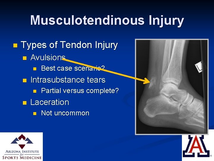 Musculotendinous Injury n Types of Tendon Injury n Avulsions n n Intrasubstance tears n