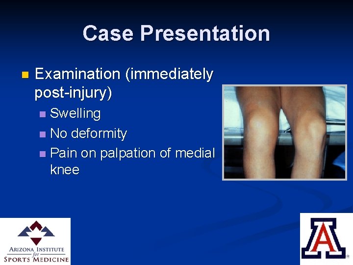 Case Presentation n Examination (immediately post-injury) Swelling n No deformity n Pain on palpation