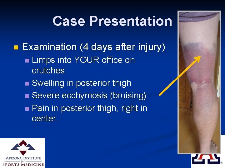 Case Presentation n Examination (4 days after injury) Limps into YOUR office on crutches