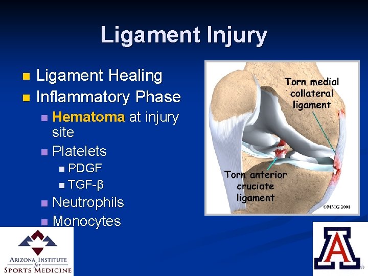 Ligament Injury Ligament Healing n Inflammatory Phase n Hematoma at injury site n Platelets