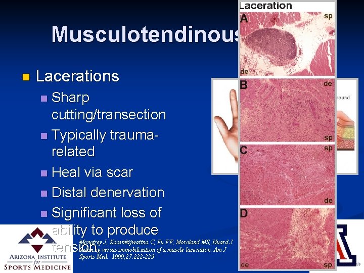 Musculotendinous Injury n Lacerations Sharp cutting/transection n Typically traumarelated n Heal via scar n