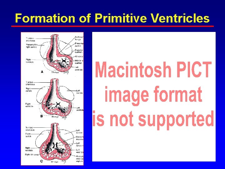 Formation of Primitive Ventricles Formation of Primitive Ventricles