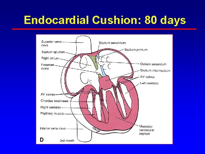 Endocardial Cushion: 80 days Endocardial Cushion: 80 days