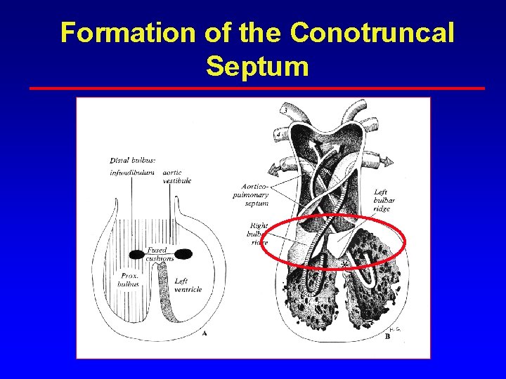 Formation of the Conotruncal Septum Formation of the Conotruncal Septum