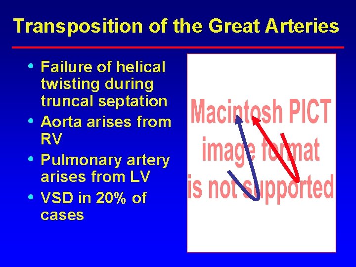 Transposition of the Great Arteries • • Failure of helical twisting during truncal septation Transposition of the Great Arteries • • Failure of helical twisting during truncal septation