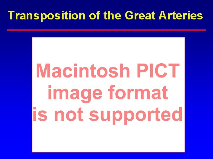 Transposition of the Great Arteries Transposition of the Great Arteries