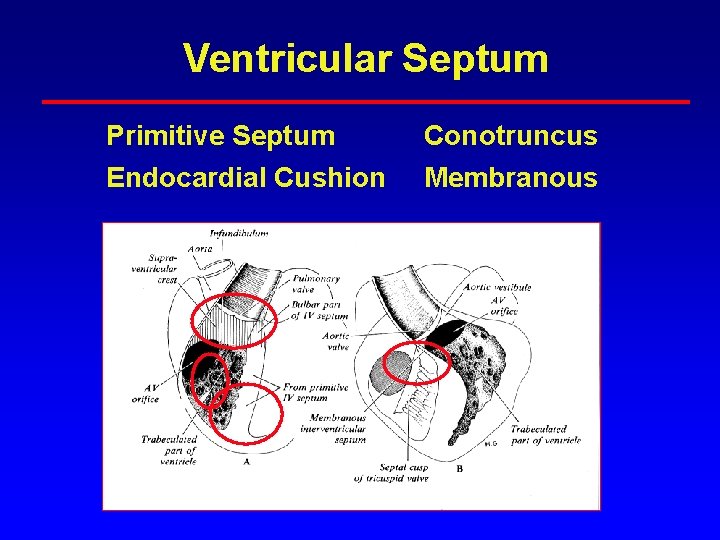 Ventricular Septum Primitive Septum Conotruncus Endocardial Cushion Membranous Ventricular Septum Primitive Septum Conotruncus Endocardial Cushion Membranous