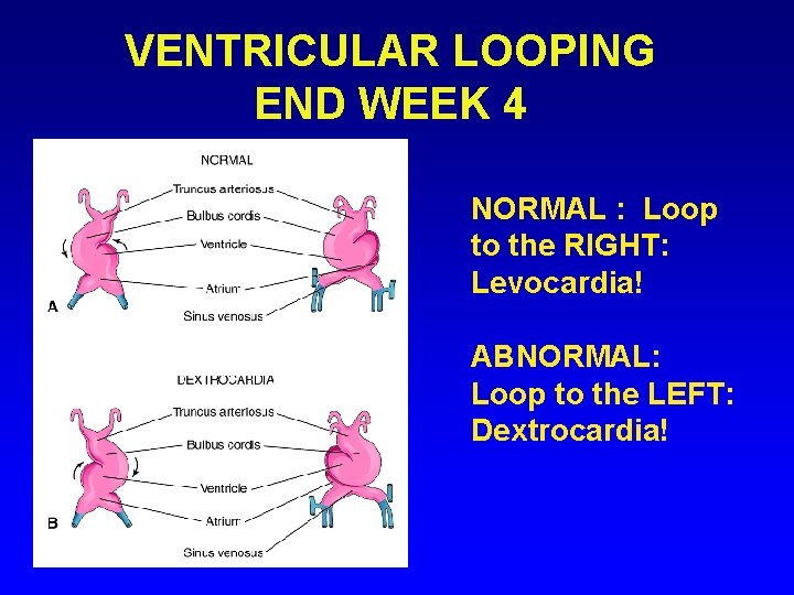 VENTRICULAR LOOPING END WEEK 4 NORMAL : Loop to the RIGHT: Levocardia! ABNORMAL: Loop VENTRICULAR LOOPING END WEEK 4 NORMAL : Loop to the RIGHT: Levocardia! ABNORMAL: Loop