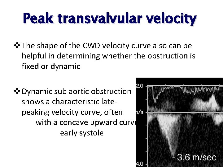Peak transvalvular velocity v The shape of the CWD velocity curve also can be Peak transvalvular velocity v The shape of the CWD velocity curve also can be