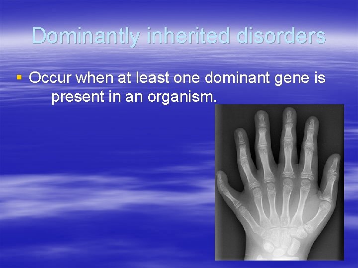 Dominantly inherited disorders § Occur when at least one dominant gene is present in