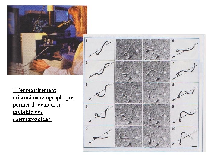 L ’enregistrement microcinématographique permet d ’évaluer la mobilité des spermatozoïdes. L ’enregistrement microcinématographique permet d ’évaluer la mobilité des spermatozoïdes.