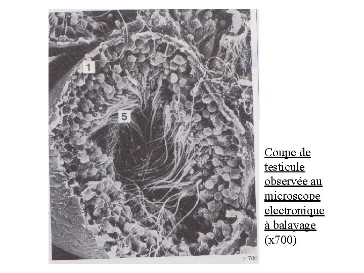 Coupe de testicule observée au microscope electronique à balayage (x 700) Coupe de testicule observée au microscope electronique à balayage (x 700)