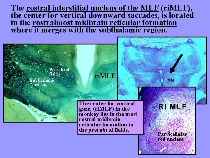 The rostral interstitial nucleus of the MLF (ri. MLF), the center for vertical downward