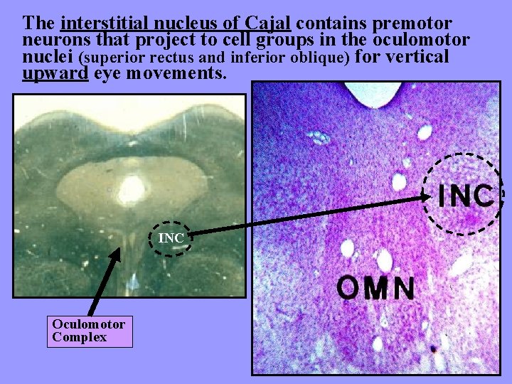 The interstitial nucleus of Cajal contains premotor neurons that project to cell groups in