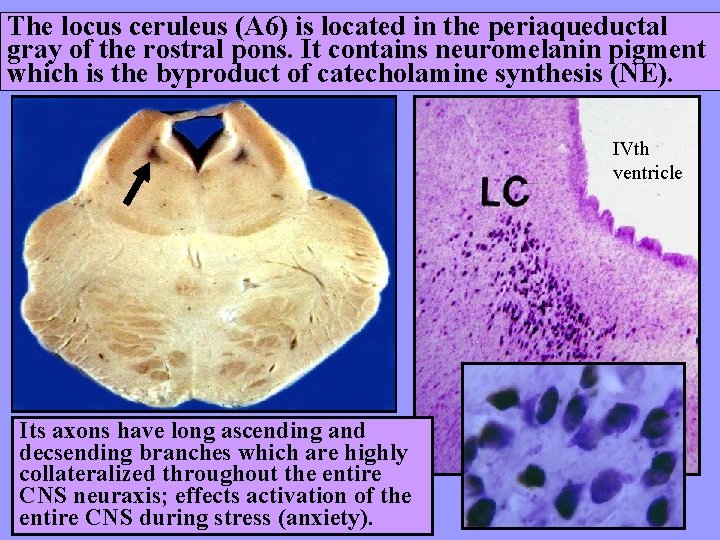 The locus ceruleus (A 6) is located in the periaqueductal gray of the rostral