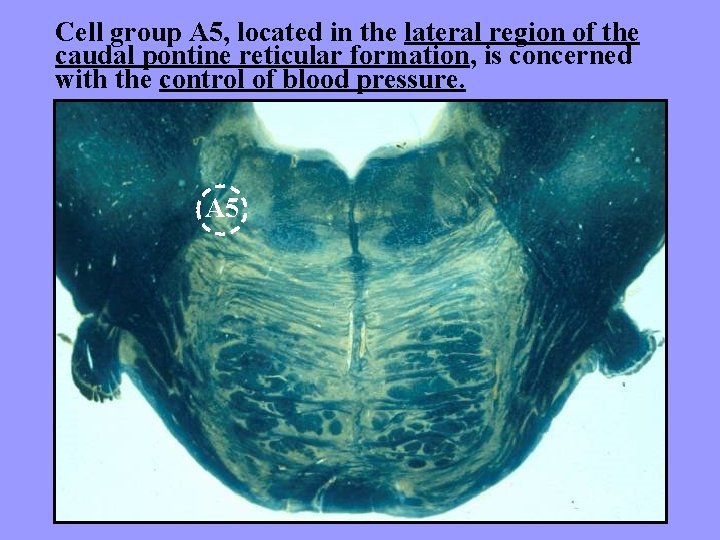 Cell group A 5, located in the lateral region of the caudal pontine reticular