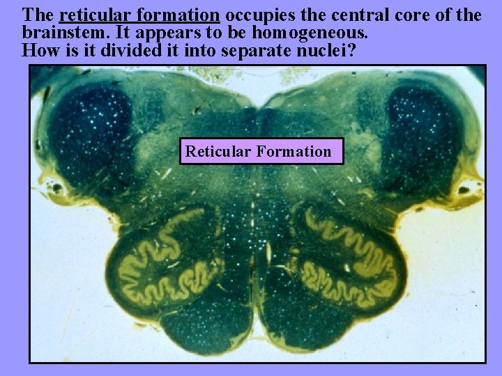 The reticular formation occupies the central core of the brainstem. It appears to be