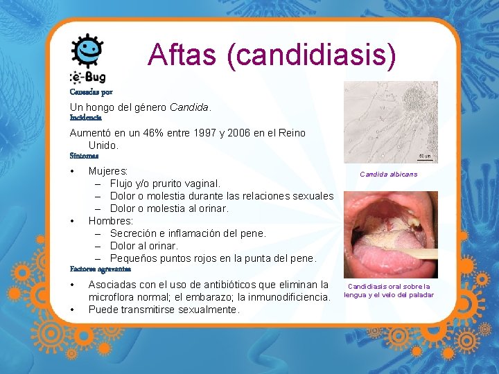 Aftas (candidiasis) Causadas por Un hongo del género Candida. Incidencia Aumentó en un 46%