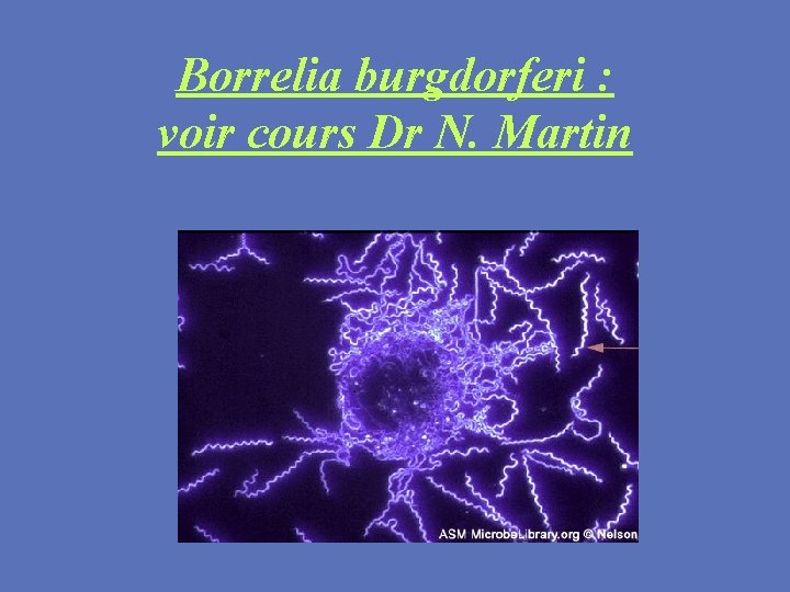 Borrelia burgdorferi : voir cours Dr N. Martin 