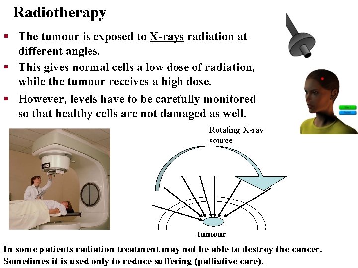 Radiotherapy § The tumour is exposed to X-rays radiation at different angles. § This