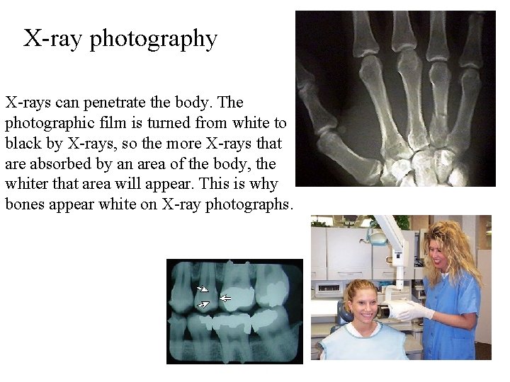 X-ray photography X-rays can penetrate the body. The photographic film is turned from white