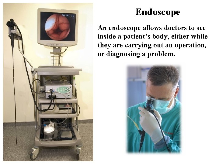 Endoscope An endoscope allows doctors to see inside a patient’s body, either while they