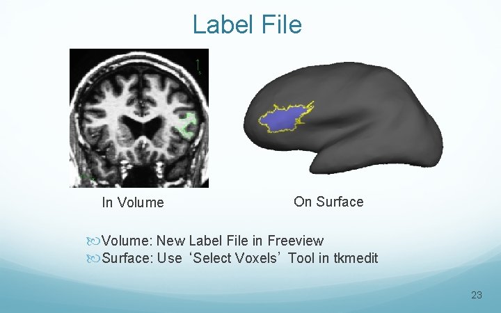 Label File In Volume On Surface Volume: New Label File in Freeview Surface: Use